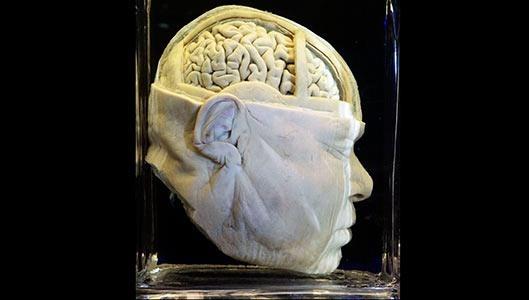 Museum Vrolik Amsterdam